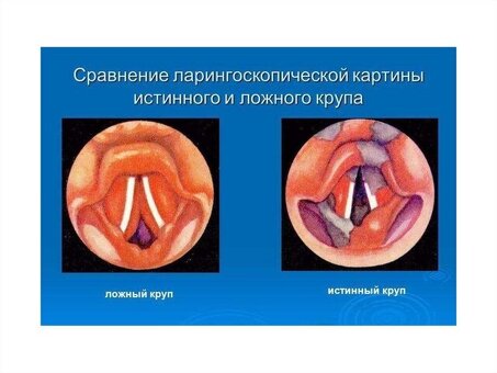 Купить крупы оптом в нашем интернет-магазине | Низкие цены и быстрая доставка.